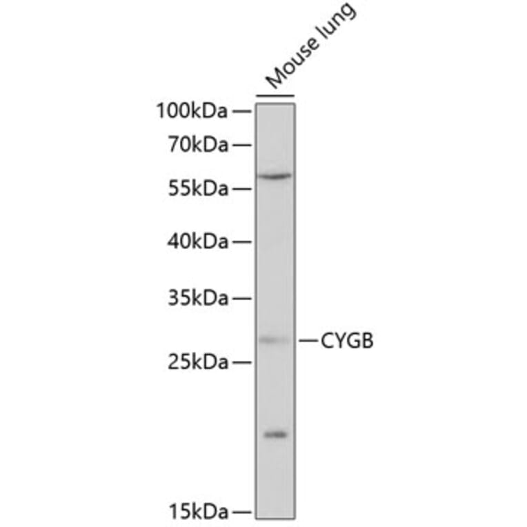Western Blot - Anti-Cytoglobin Antibody (A88709) - Antibodies.com