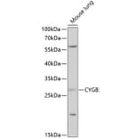 Western Blot - Anti-Cytoglobin Antibody (A88709) - Antibodies.com