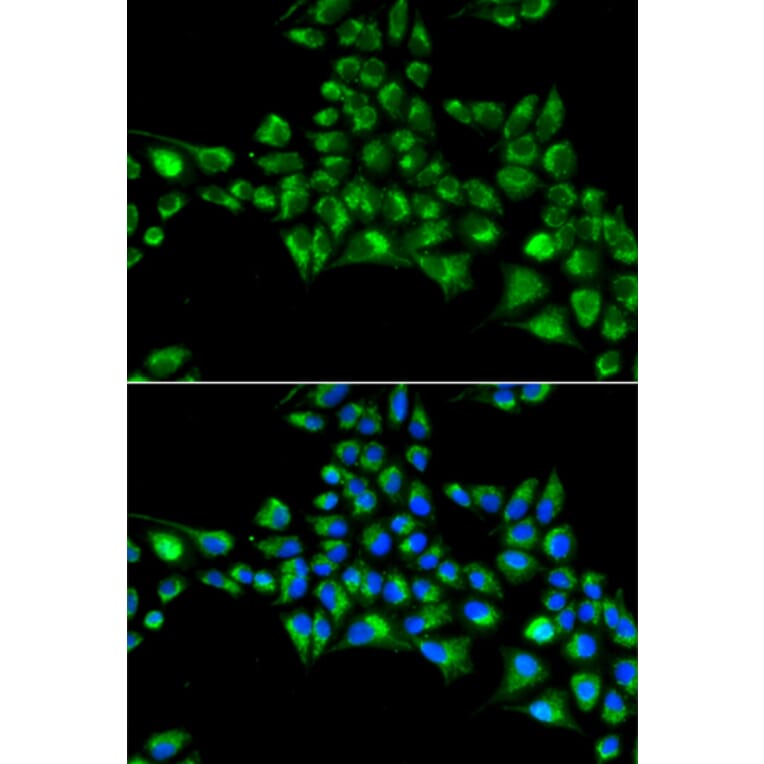 Immunofluorescence - Anti-Cytoglobin Antibody (A88709) - Antibodies.com