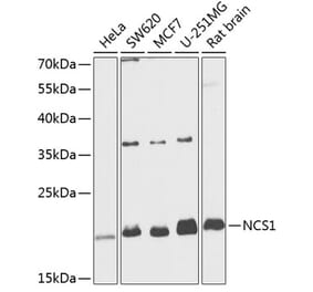 Western Blot - Anti-NCS1 Antibody (A88710) - Antibodies.com