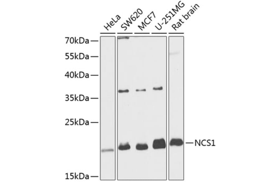 Western Blot - Anti-NCS1 Antibody (A88710) - Antibodies.com