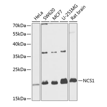 Western Blot - Anti-NCS1 Antibody (A88710) - Antibodies.com