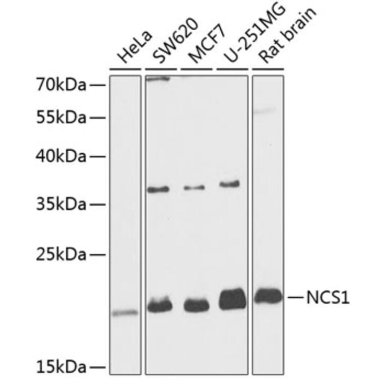 Western Blot - Anti-NCS1 Antibody (A88710) - Antibodies.com