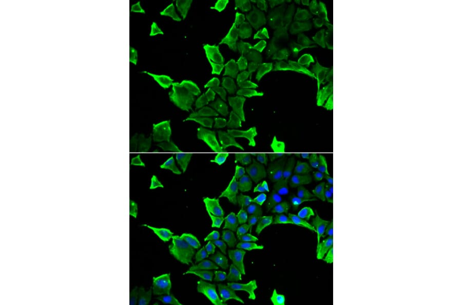 Immunofluorescence - Anti-NCS1 Antibody (A88710) - Antibodies.com