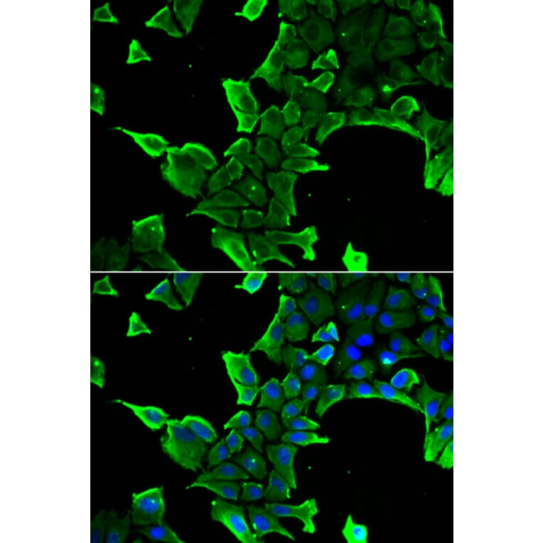 Immunofluorescence - Anti-NCS1 Antibody (A88710) - Antibodies.com