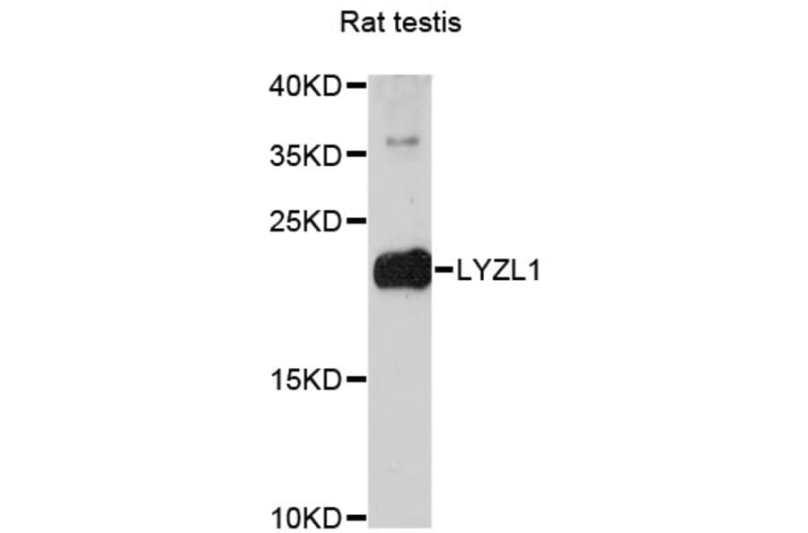 Western Blot - Anti-LYZL1 Antibody (A13823) - Antibodies.com