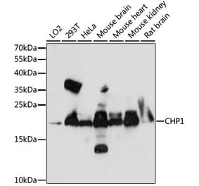 Western Blot - Anti-Calcium binding protein P22 Antibody (A88712) - Antibodies.com