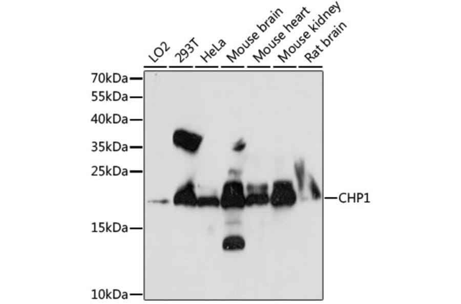 Western Blot - Anti-Calcium binding protein P22 Antibody (A88712) - Antibodies.com