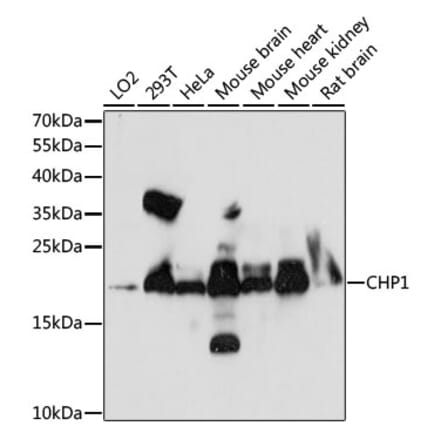 Western Blot - Anti-Calcium binding protein P22 Antibody (A88712) - Antibodies.com