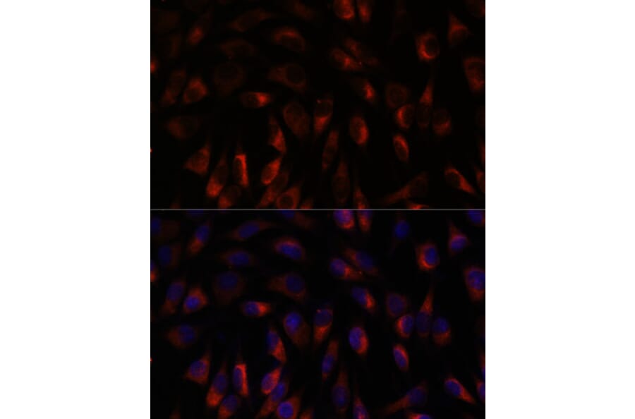 Immunofluorescence - Anti-Calcium binding protein P22 Antibody (A88712) - Antibodies.com