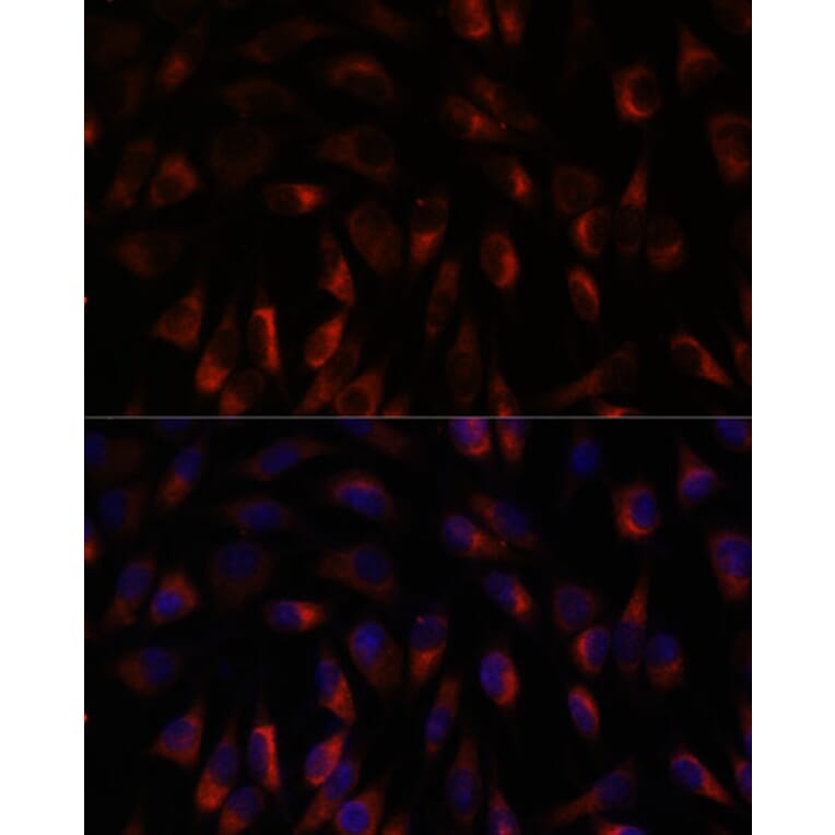 Immunofluorescence - Anti-Calcium binding protein P22 Antibody (A88712) - Antibodies.com