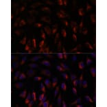 Immunofluorescence - Anti-Calcium binding protein P22 Antibody (A88712) - Antibodies.com