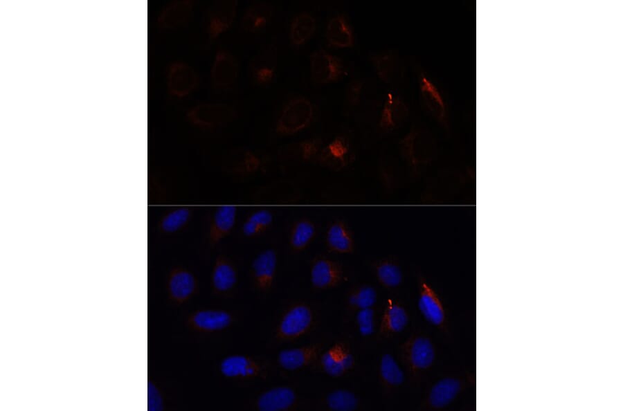 Immunofluorescence - Anti-Calcium binding protein P22 Antibody (A88712) - Antibodies.com