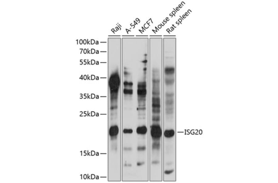 Western Blot - Anti-ISG20 Antibody (A88714) - Antibodies.com