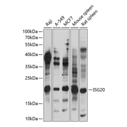 Western Blot - Anti-ISG20 Antibody (A88714) - Antibodies.com