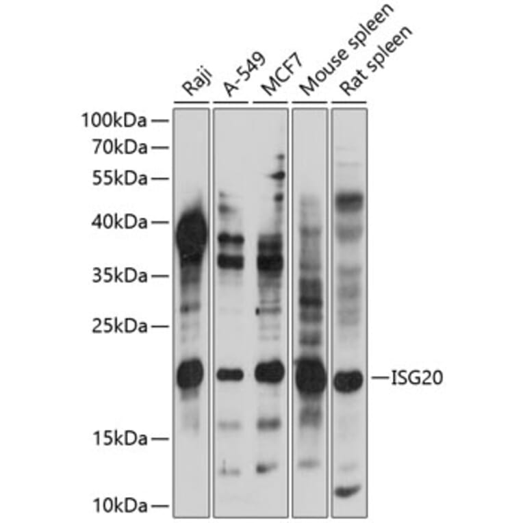 Western Blot - Anti-ISG20 Antibody (A88714) - Antibodies.com