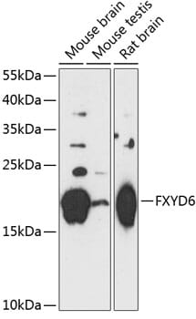 Western blot analysis of extracts of various cell lines, using Anti-FXYD6 Antibody (A14339) at 1:3000 dilution.
Secondary antibody: Goat Anti-Rabbit IgG (H+L) (HRP) (AS014) at 1:10,000 dilution.
Lysates / proteins: 25µg per lane.
Blocking buffer: 3% non-fat dry milk in TBST.
Detection: ECL Basic Kit (RM00020).
Exposure time: 90s.