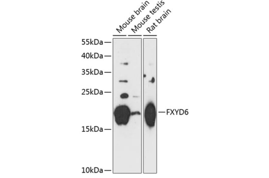 Western Blot - Anti-FXYD6/Plp Antibody (A88716) - Antibodies.com