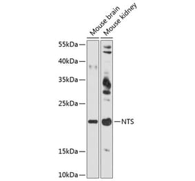 Western Blot - Anti-Neurotensin Antibody (A88717) - Antibodies.com