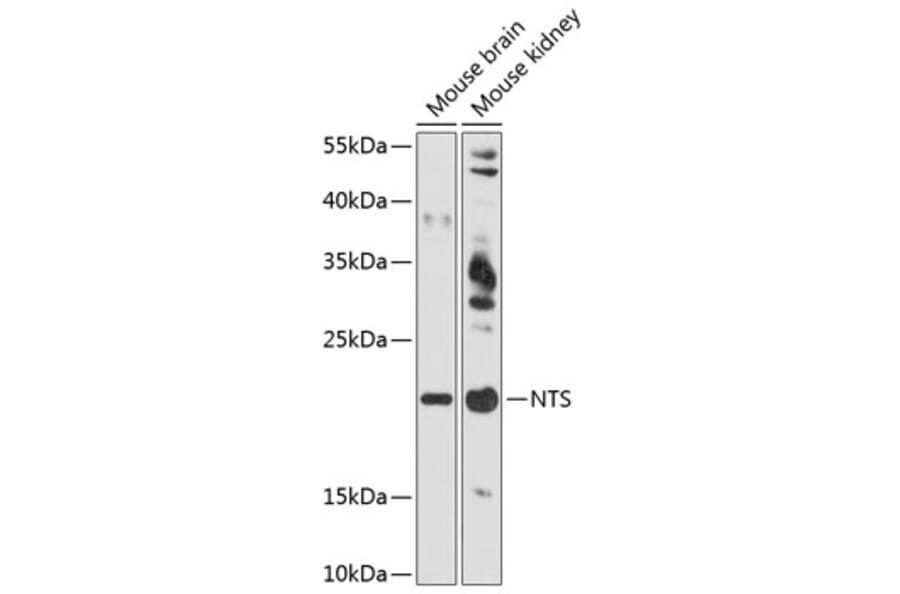 Western Blot - Anti-Neurotensin Antibody (A88717) - Antibodies.com
