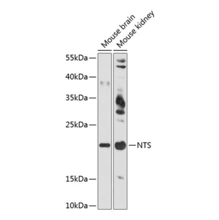 Western Blot - Anti-Neurotensin Antibody (A88717) - Antibodies.com