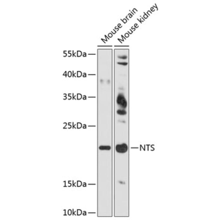Western Blot - Anti-Neurotensin Antibody (A88717) - Antibodies.com