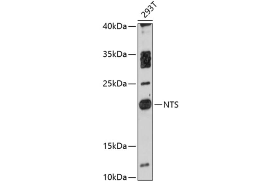 Western Blot - Anti-Neurotensin Antibody (A88718) - Antibodies.com