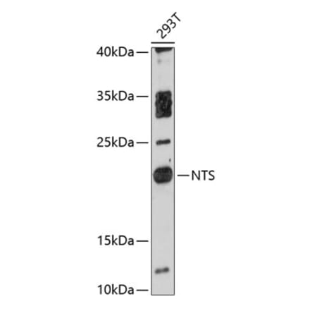 Western Blot - Anti-Neurotensin Antibody (A88718) - Antibodies.com