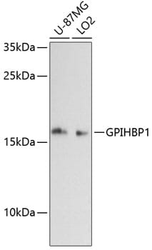 Western blot analysis of extracts of various cell lines, using Anti-GPIHBP1 Antibody (A13240) at 1:3000 dilution.
Secondary antibody: Goat Anti-Rabbit IgG (H+L) (HRP) (AS014) at 1:10,000 dilution.
Lysates / proteins: 25µg per lane.
Blocking buffer: 3% non-fat dry milk in TBST.
Detection: ECL Basic Kit (RM00020).
Exposure time: 90s.
