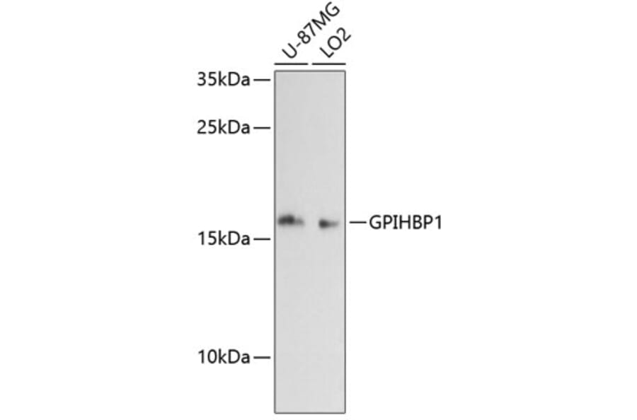 Western Blot - Anti-Gpihbp1 Antibody (A88719) - Antibodies.com