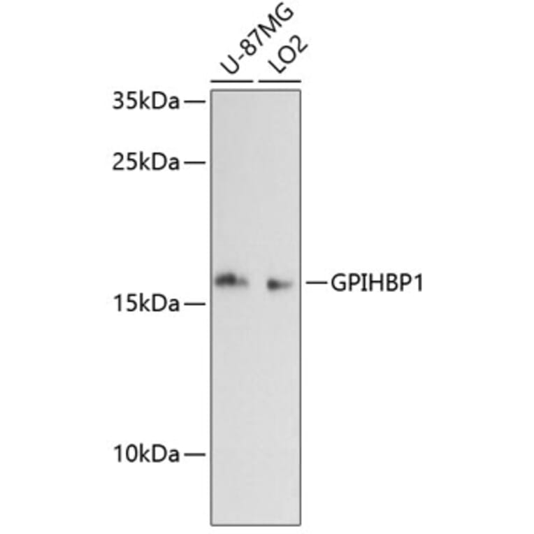 Western Blot - Anti-Gpihbp1 Antibody (A88719) - Antibodies.com