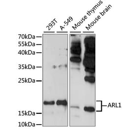 Western Blot - Anti-ARL 1 Antibody (A88720) - Antibodies.com