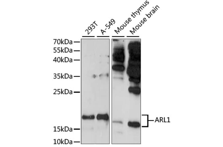 Western Blot - Anti-ARL 1 Antibody (A88720) - Antibodies.com