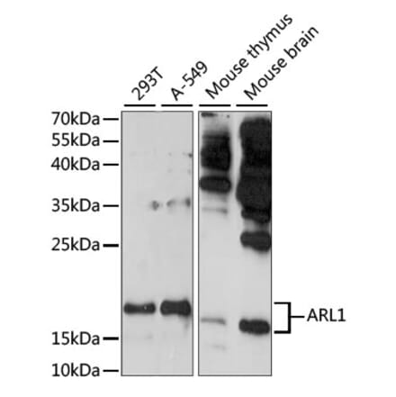 Western Blot - Anti-ARL 1 Antibody (A88720) - Antibodies.com