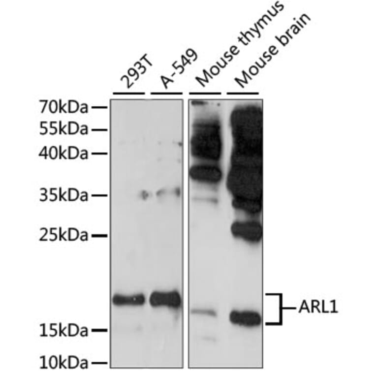 Western Blot - Anti-ARL 1 Antibody (A88720) - Antibodies.com