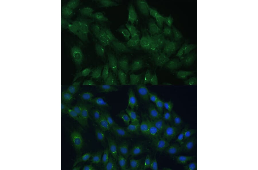Immunofluorescence - Anti-ARL 1 Antibody (A88720) - Antibodies.com