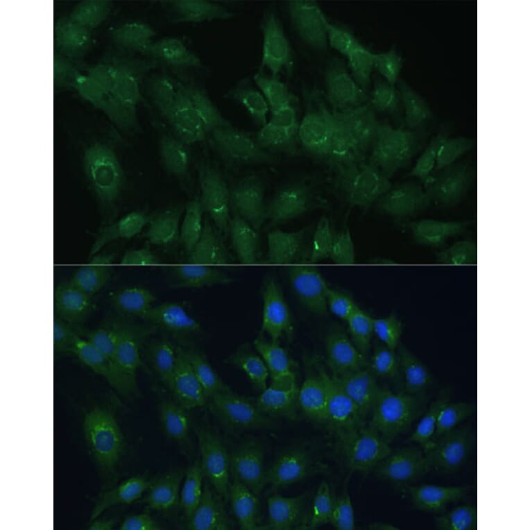 Immunofluorescence - Anti-ARL 1 Antibody (A88720) - Antibodies.com