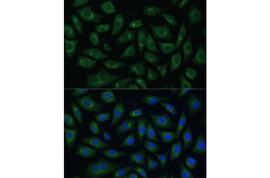 Immunofluorescence - Anti-ARL 1 Antibody (A88720) - Antibodies.com