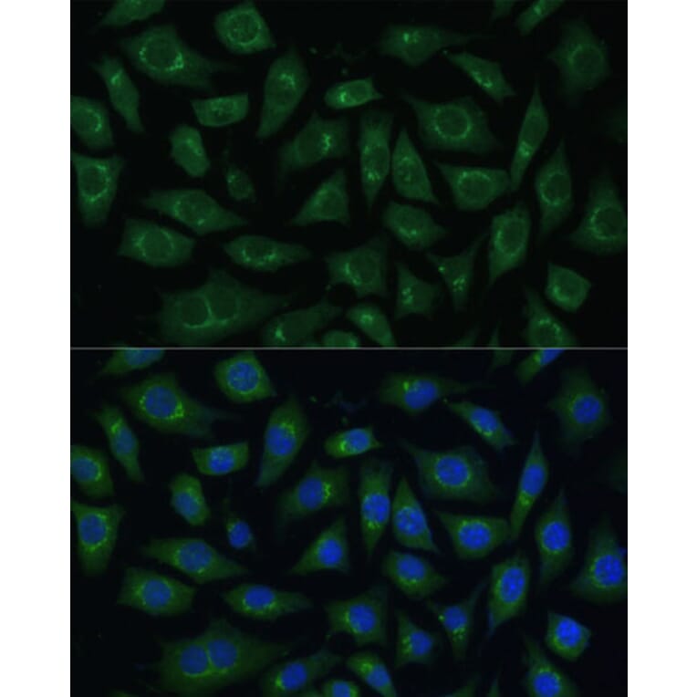 Immunofluorescence - Anti-ARL 1 Antibody (A88720) - Antibodies.com