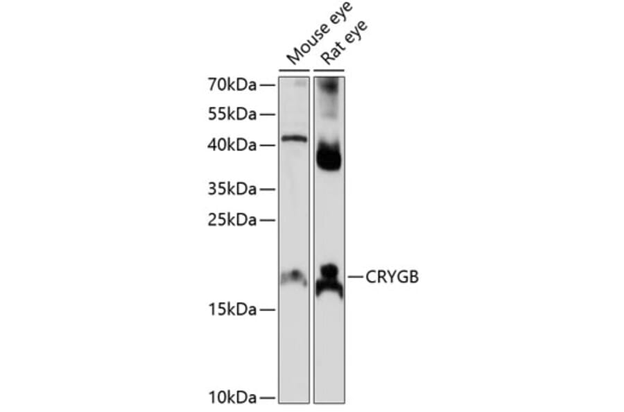 Western Blot - Anti-Gamma B crystallin Antibody (A88721) - Antibodies.com