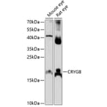 Western Blot - Anti-Gamma B crystallin Antibody (A88721) - Antibodies.com