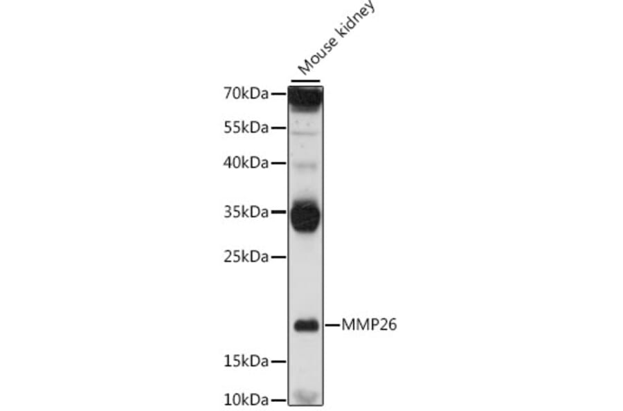 Western Blot - Anti-MMP26 Antibody (A16135) - Antibodies.com