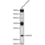 Western Blot - Anti-MMP26 Antibody (A16135) - Antibodies.com