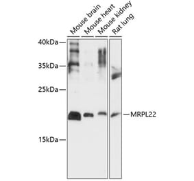 Western Blot - Anti-MRPL22 Antibody (A88723) - Antibodies.com
