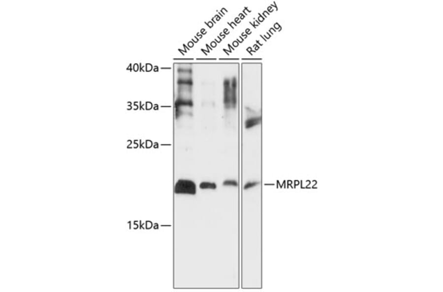Western Blot - Anti-MRPL22 Antibody (A88723) - Antibodies.com