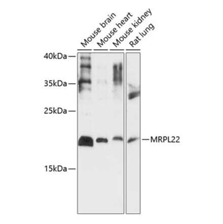 Western Blot - Anti-MRPL22 Antibody (A88723) - Antibodies.com