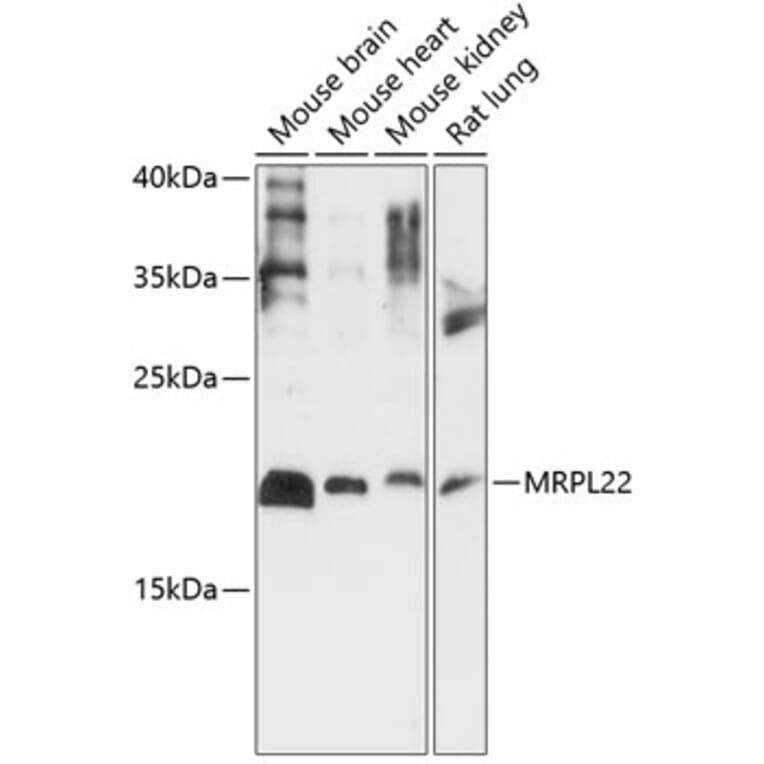 Western Blot - Anti-MRPL22 Antibody (A88723) - Antibodies.com