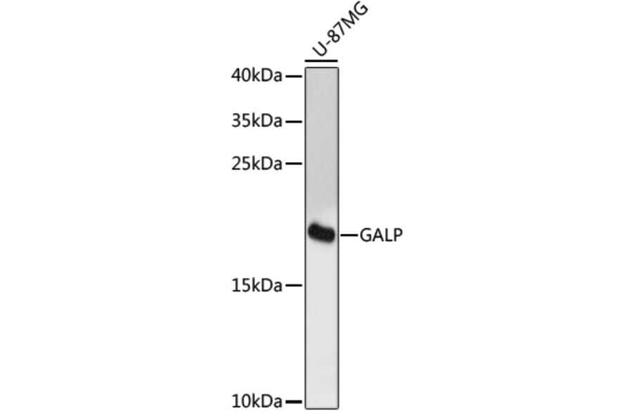 Western Blot - Anti-GALP Antibody (A88724) - Antibodies.com