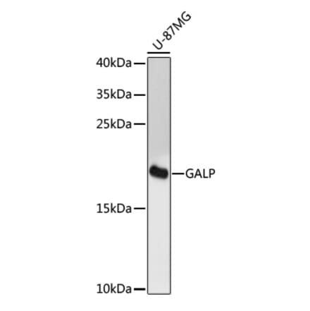 Western Blot - Anti-GALP Antibody (A88724) - Antibodies.com