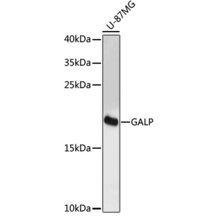 Western Blot - Anti-GALP Antibody (A88724) - Antibodies.com